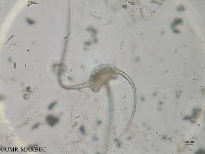 phyto/Brazilian_Nordeste/Seamounts_station60/ABRACOS2 April 2017/Tripos hexacanthus (st58_Sup_tripos_novo170829_001_ovl)(copy)_thumb.jpg